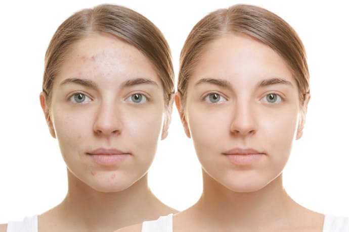 Ästhetik Gesunde Haut ohne Makel - Home